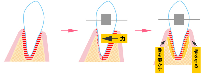 力 骨を溶かす 骨を作る